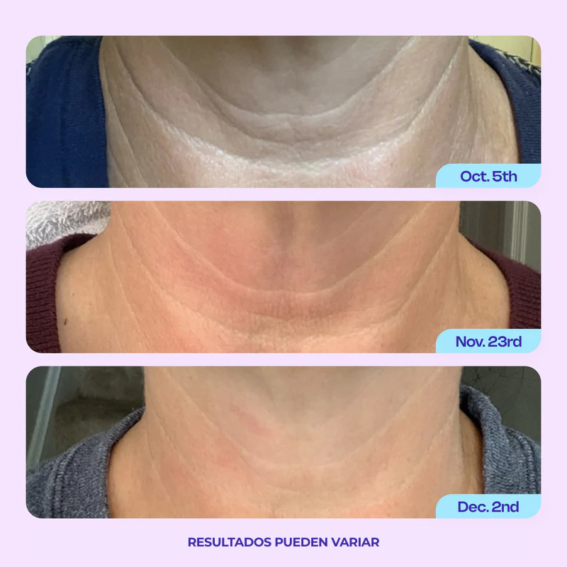 Crema Reafirmante para Cuello ProLift™