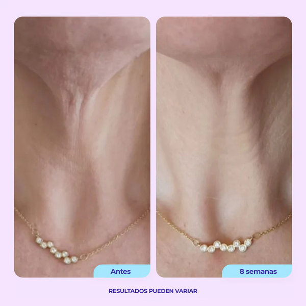 Crema Reafirmante para Cuello ProLift™