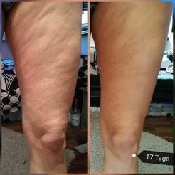 Rodillo de Masaje Anticelulitis FasciaFlow™